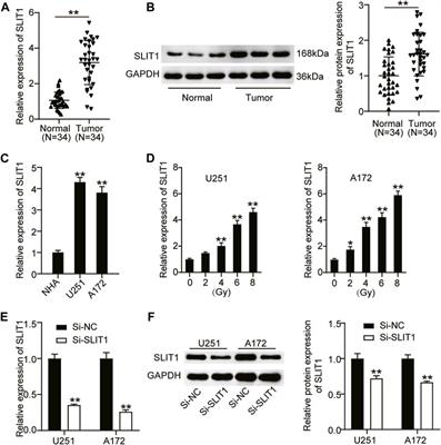 Micro RNA-640 Targeting SLIT1 Enhances Glioma Radiosensitivity by Restraining the Activation of Wnt/β-Catenin Signaling Pathway